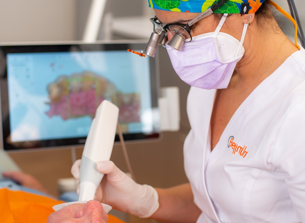 ventajas del escáner intraoral