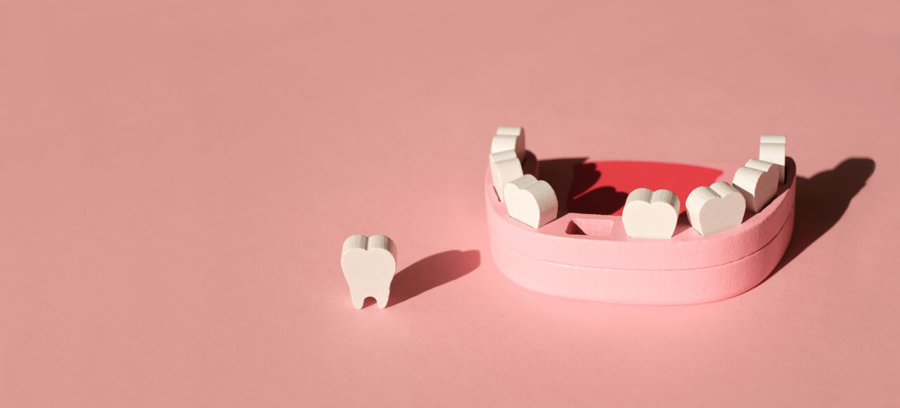 reponer los dientes perdidos
